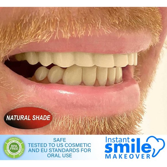 Instant Smile Makeover Comfort Flex Fit Top Upper Veneers - Natural Shade - Picture 5 of 6
